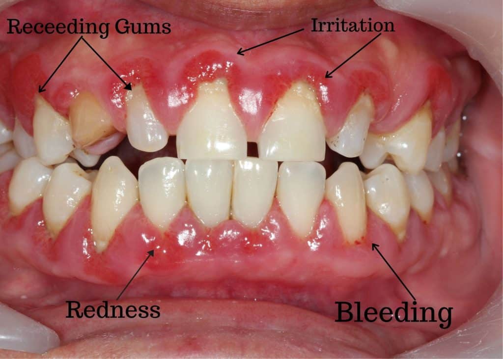 The Dangers Of Ignoring Dental Health